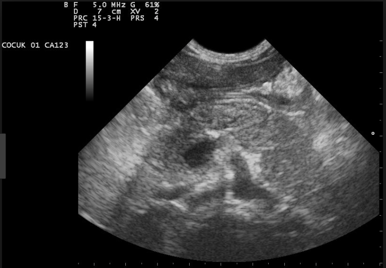 Ultrasound of a human fetus
