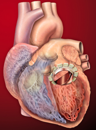 Artist rendering of human heart