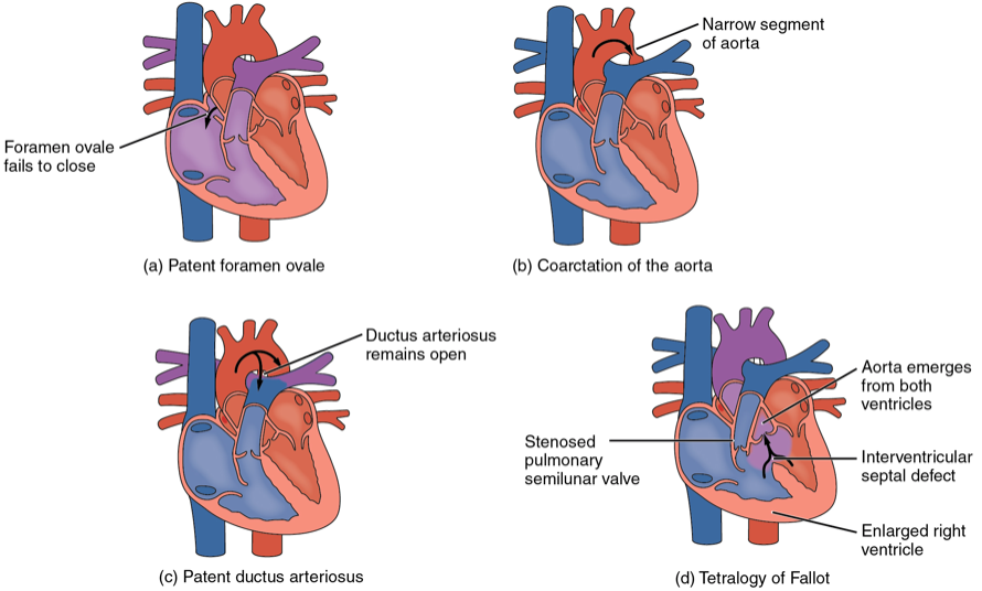 Congenital Heart Disease In Adults 1: Terminology And Embryology image