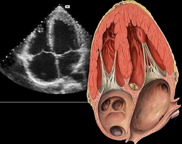 Echo Exam 2: Basic TEE, TTE, And Emergency Algorithms image