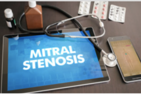 Mitral Stenosis course image
