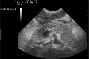 Ultrasound Artifacts 5: Image Optimization image