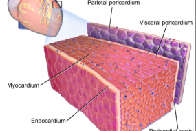 Masses, Pericardial And Myocardial Disease 3: Pericardial Disease image